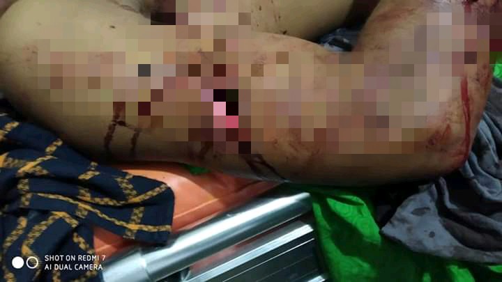 Pemuda Tewas Ditikam di Lokasi Pesta Pernikahan di Kota Baru